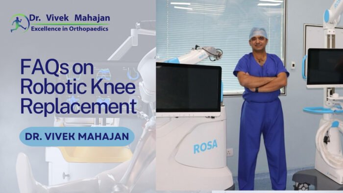 Robotic Knee Replacement FAQs
