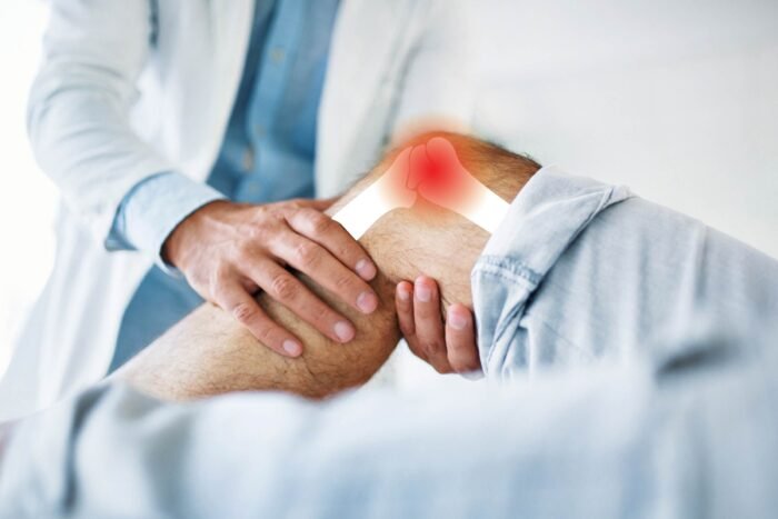 Understanding Knee Osteoarthritis and Treatment Options