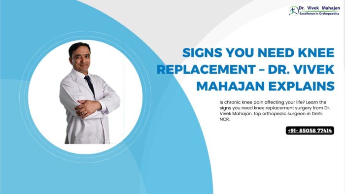 Signs You Need Knee Replacement